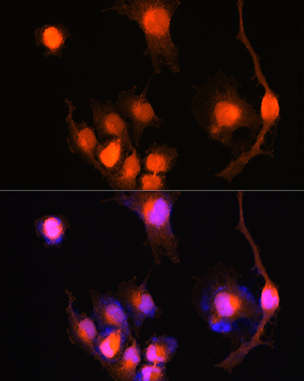 UCHL1 Antibody