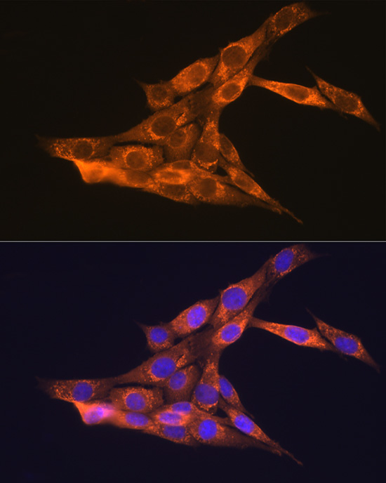 VEGFB Antibody