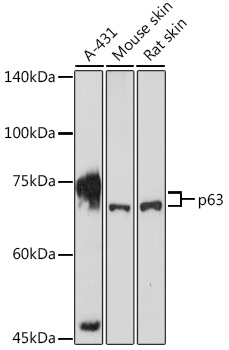 TP63 Antibody