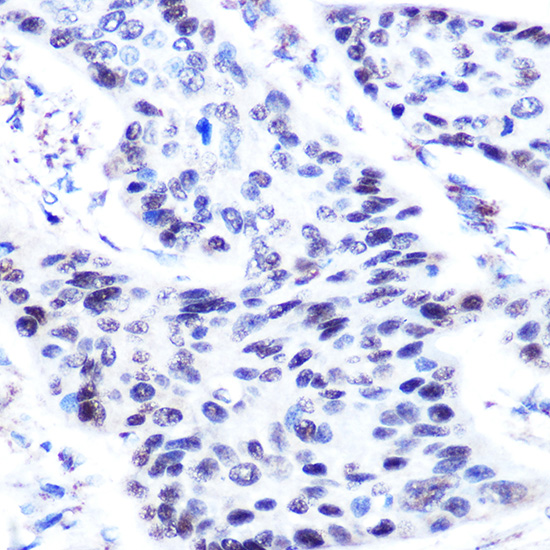 TP63 Antibody