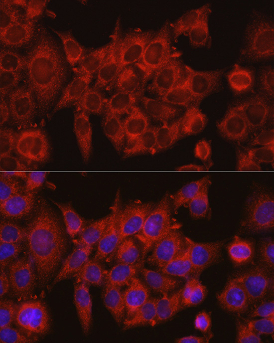 IDH1 Antibody