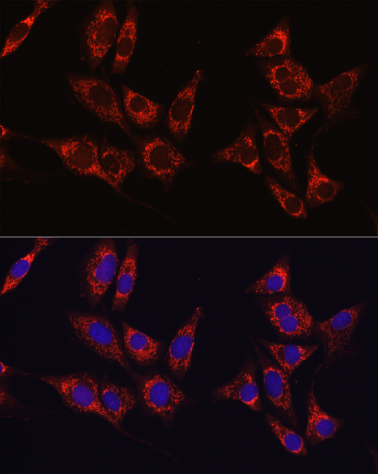 IDH1 Antibody