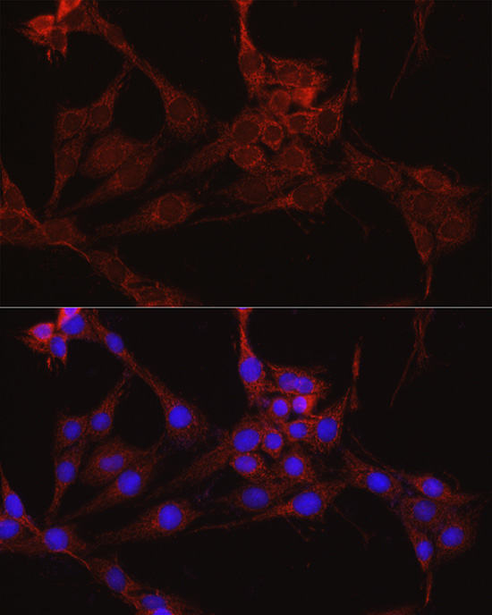 IDH1 Antibody