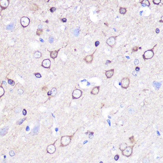 STMN1 Antibody