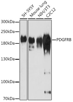 PDGFRB Antibody