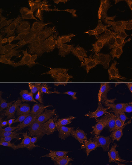 PDGFRB Antibody