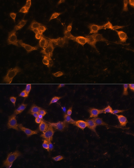 PDGFRB Antibody