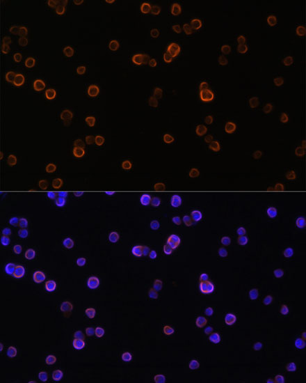 PLCG2 Antibody