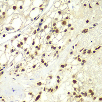 RPA2 Antibody