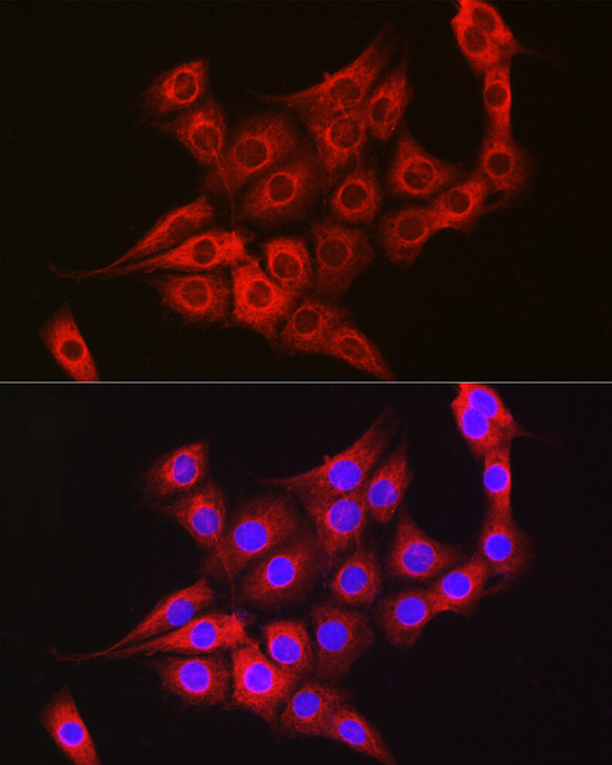 TTK Antibody