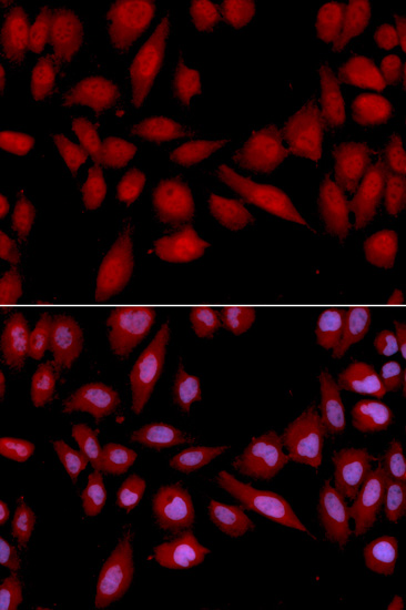 PSMA2 Antibody