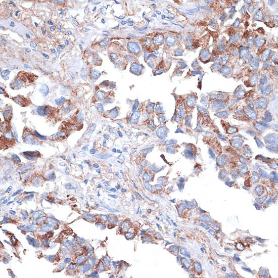 HAVCR2 Antibody