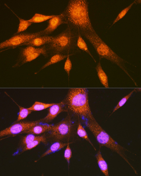 PCBP2 Antibody