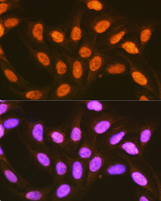 PCBP2 Antibody