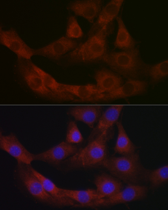 PRG2 Antibody