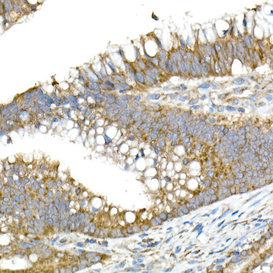 MMP14 Antibody