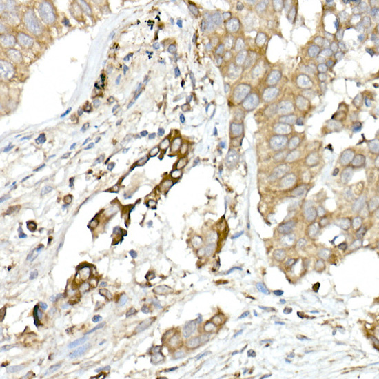 MMP14 Antibody