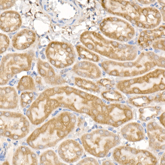 MMP14 Antibody