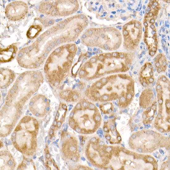 MMP14 Antibody