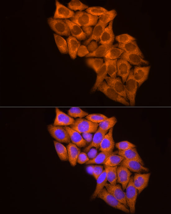 MMP14 Antibody