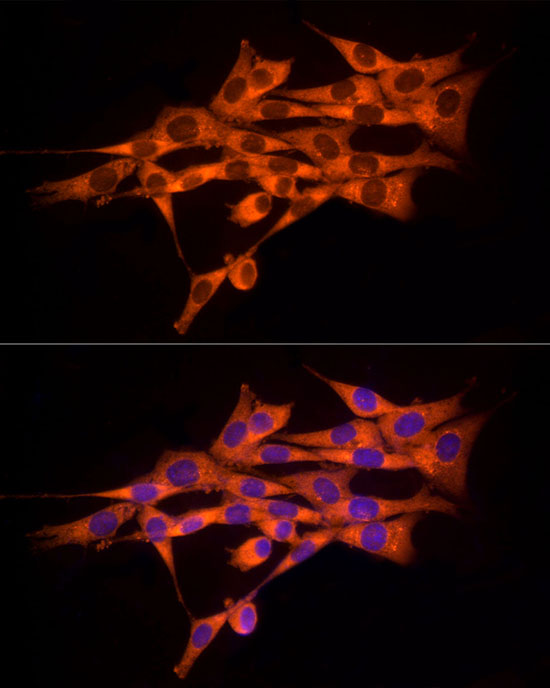 MMP14 Antibody