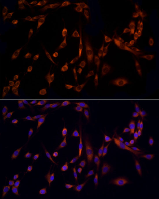 MMP14 Antibody