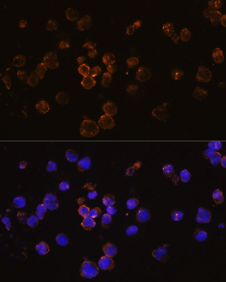 TNFSF11 Antibody