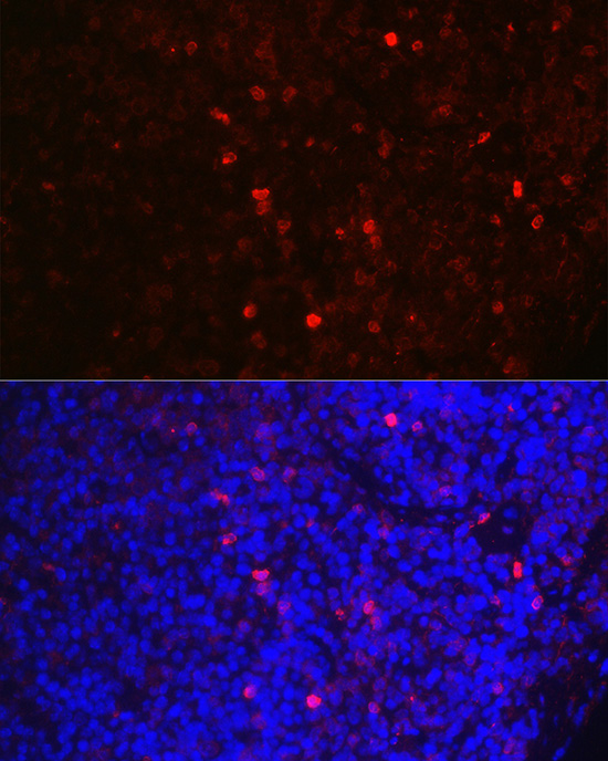 GZMB Antibody