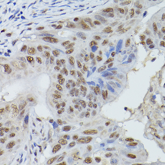 MRE11A Antibody