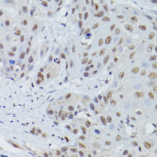 MRE11A Antibody