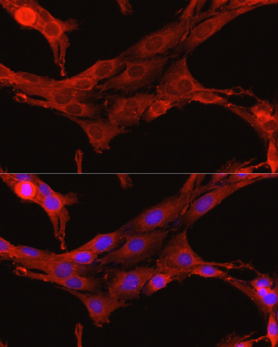 TGFBI Antibody