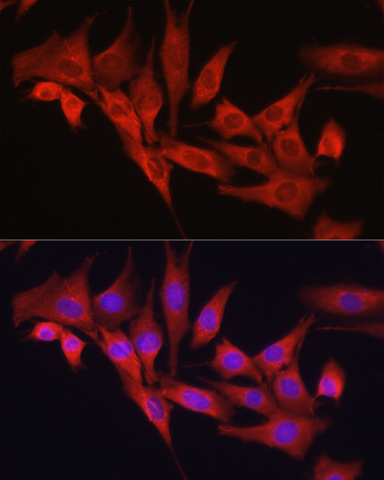 TGFBI Antibody