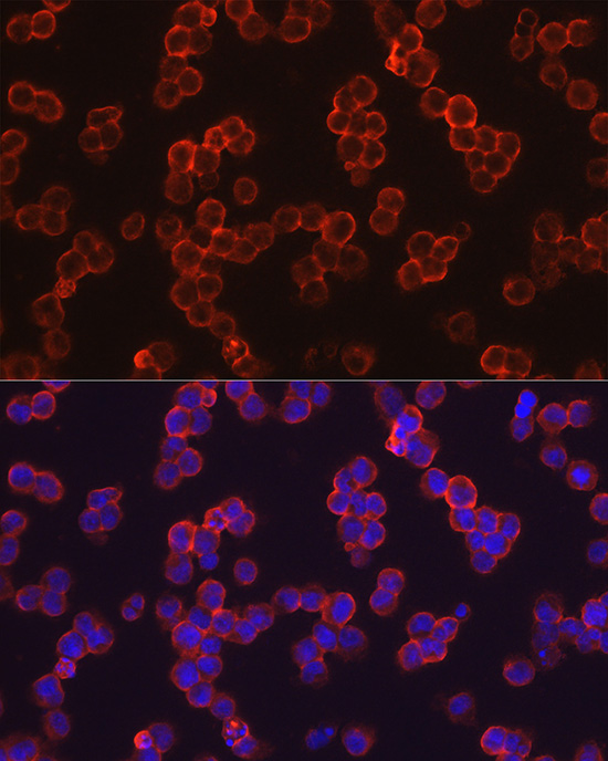 TGFBI Antibody