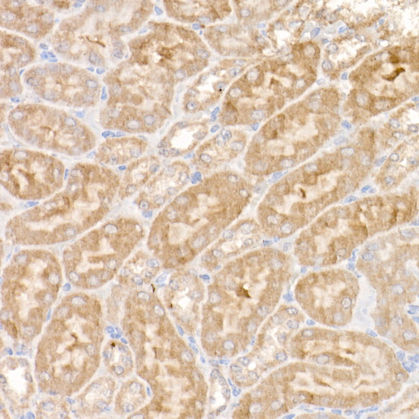 NDUFS1 Antibody