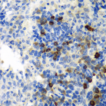 AIMP1 Antibody