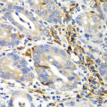 AIMP1 Antibody