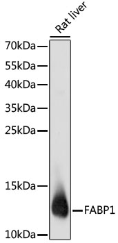 FABP1 Antibody