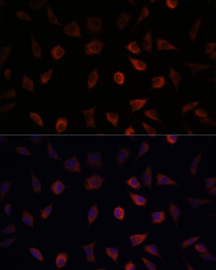 FABP1 Antibody