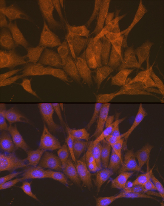 PRKACB Antibody