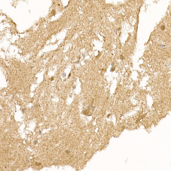 RCAN1 Antibody