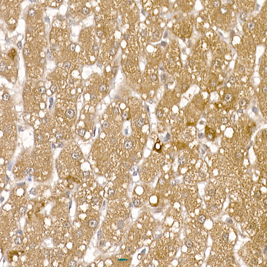 RCAN1 Antibody