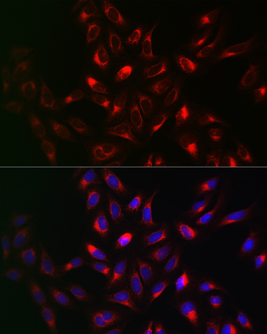 VAPB Antibody