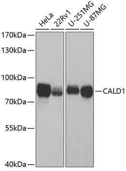 CALD1 Antibody