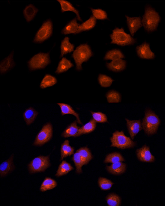 DBI Antibody