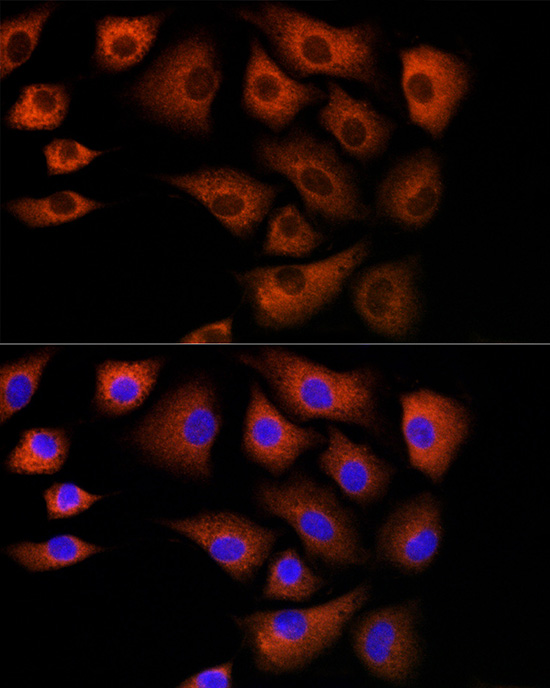 DBI Antibody