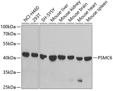 PSMC6 Antibody