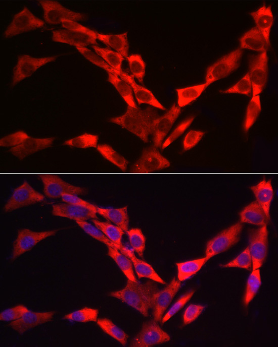 WIF1 Antibody