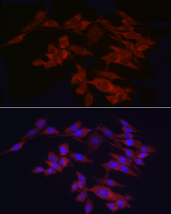 WIF1 Antibody