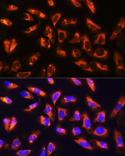 ADAM9 Antibody