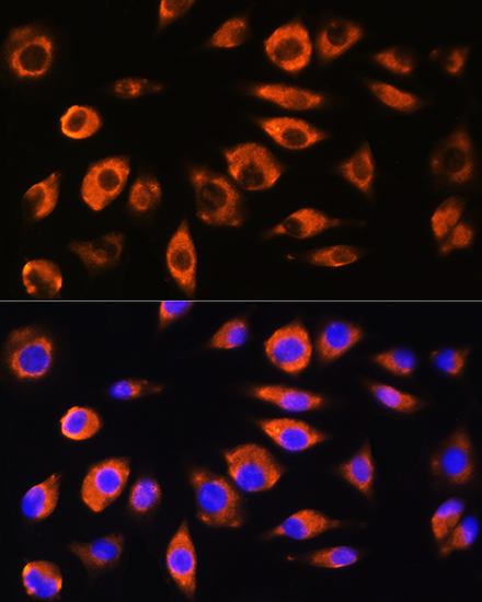 ADAM9 Antibody